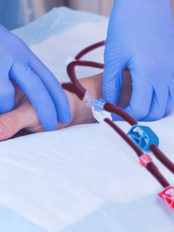 DIALYSIS
